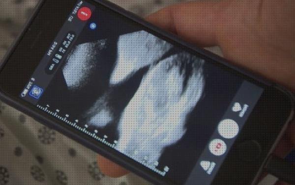 Las mejores ecografías bebe ecografías ecografía bebe con móvil