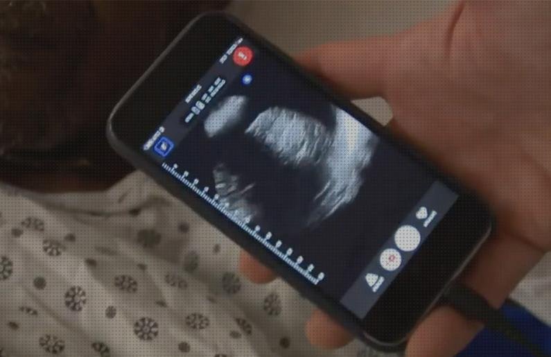 Review de ecografía bebe con móvil
