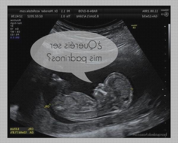 Las mejores ecografías bebe ecografías ecografía bebe corte de manga