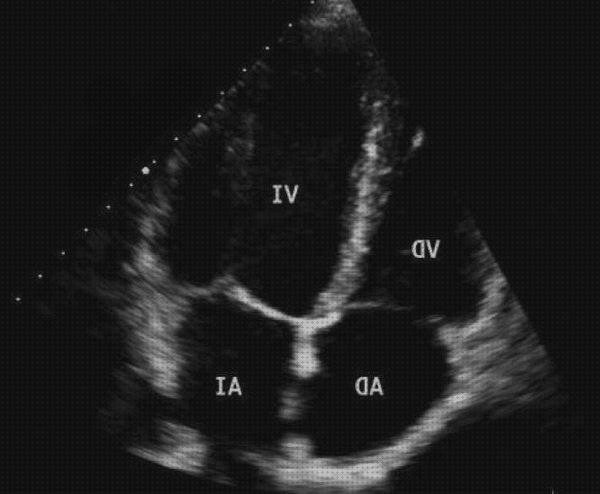 ¿Dónde poder comprar ecografías ecografía cardiaca?