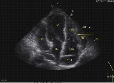 Las mejores marcas de ecografías ecografía cardiaca