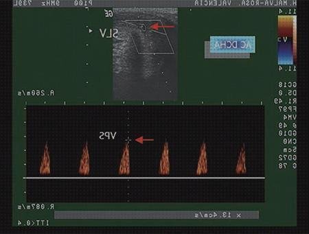¿Dónde poder comprar ecografía carotídea gimc?