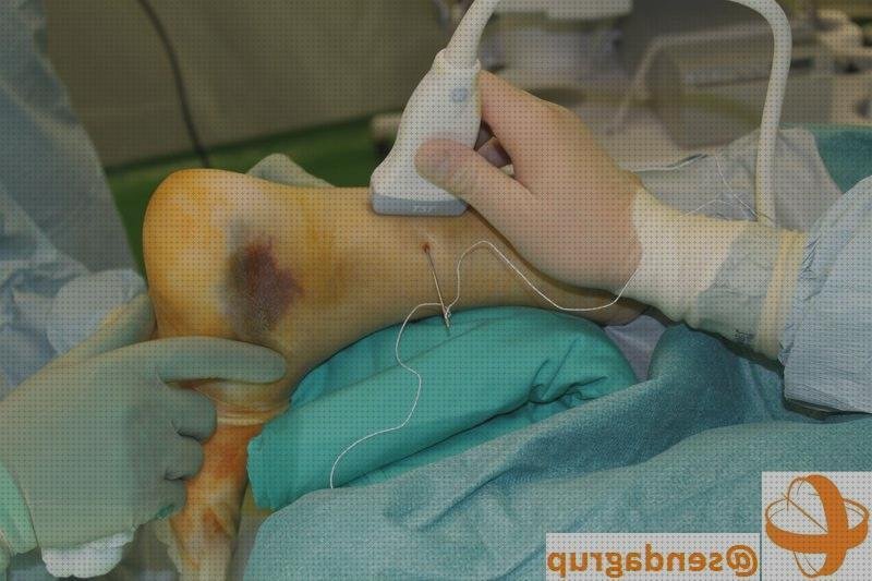 Las 4 Mejores Ecografías Cirugías Endocrina