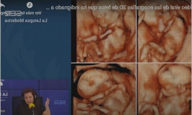 ¿Dónde poder comprar ecografía cabeza grande Mas ecografía coneja ecografías ecografía con cabeza de marciano?