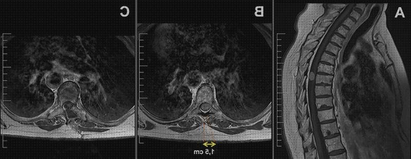 Review de ecografía con cabeza de marciano