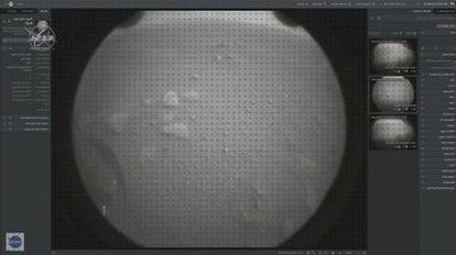 Análisis de las 10 mejores Ecografías Con Cabezas De Marcianos