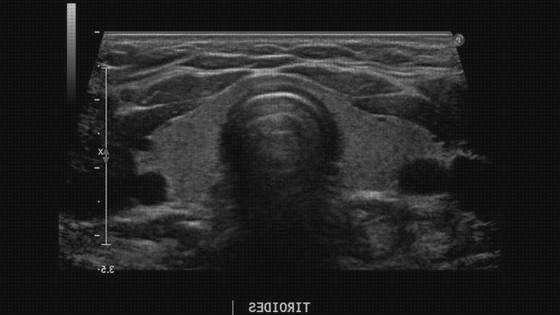 Opiniones de contraste ecografía con contraste cervical