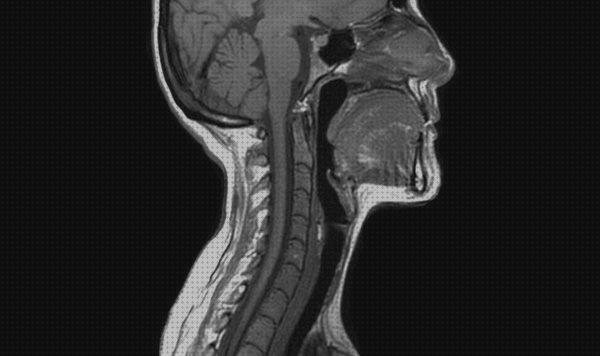 Análisis de las 9 mejores Ecografías Con Contrastes Cervicales