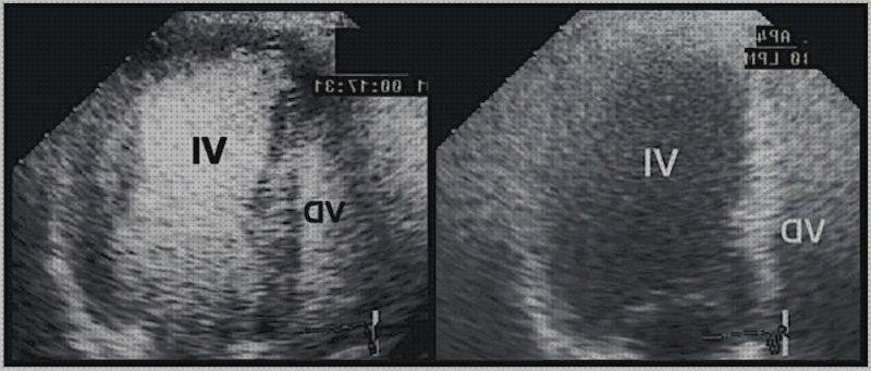 Las 8 Mejores Ecografías Con Contrastes Ecocardiografía