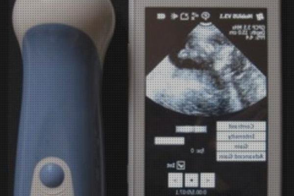Las mejores movil ecografía con movil