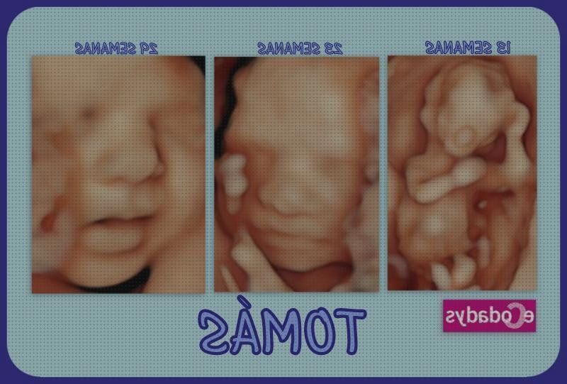 Las mejores ecografía 20 semanas niña ecografía once semanas ecografía de 20 semanas 5d