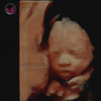¿Dónde poder comprar ecografía 28 semanas niña ecografía once semanas ecografía de 28 semanas de embarazo?