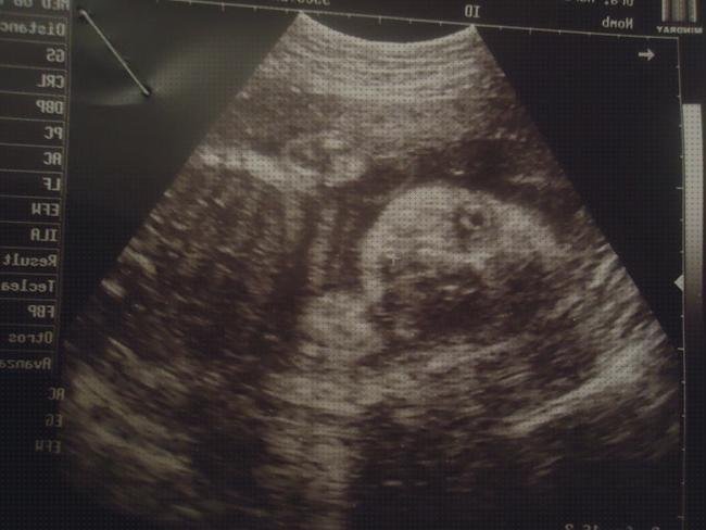 Review de ecografía de 28 semanas de embarazo