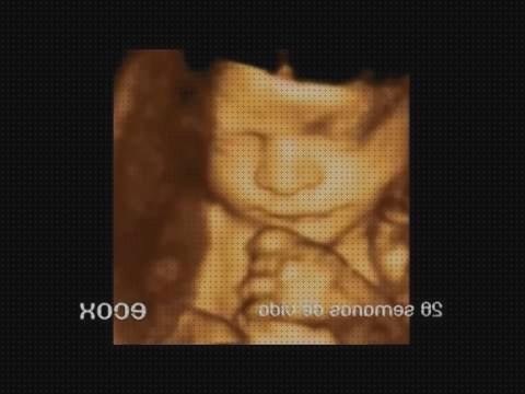 Las mejores 13 Ecografías De 28 Semanas De Embarazos