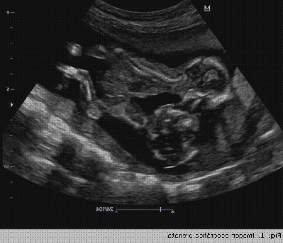 Las mejores ecografías bebe ecografías ecografía de bebe en republica dominicana