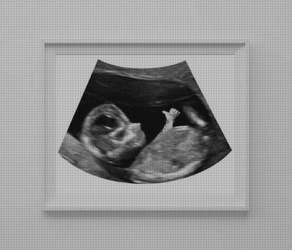 Review de ecografía de bebe en republica dominicana