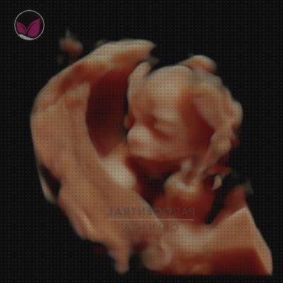 Las mejores ecografía once semanas ecografía de chico 20 semanas