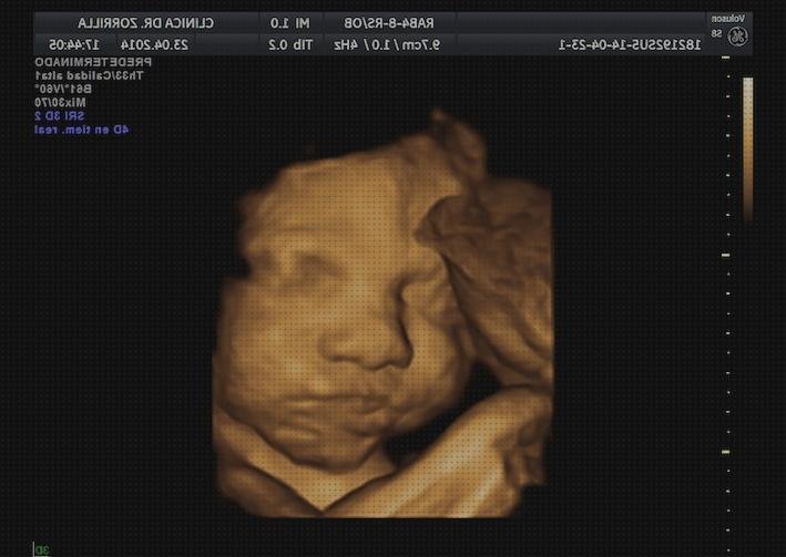 Las mejores ecografía 3 semanas embarazo ecografía once semanas ecografía de embarazo normal 22 semanas