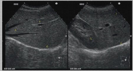 ¿Dónde poder comprar ecografía hígado gato Mas ecografía cabeza grande Mas ecografía coneja ecografía de hígado patologías?
