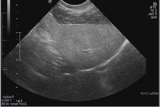Las mejores ecografía hígado gato Mas ecografía cabeza grande Mas ecografía coneja ecografía de hígado patologías