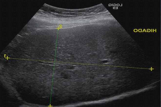 Opiniones de ecografía hígado gato Mas ecografía cabeza grande Mas ecografía coneja ecografía de hígado patologías