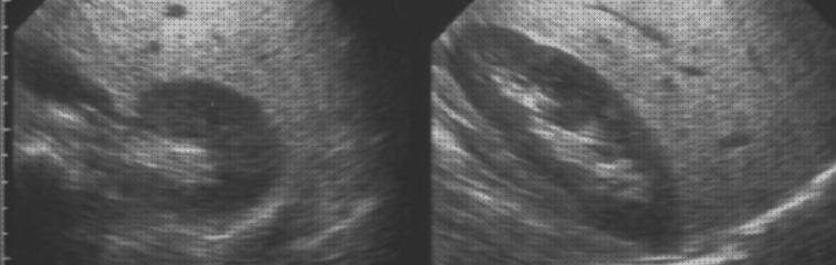 Análisis de las 11 mejores Ecografías De Hígados Patologías