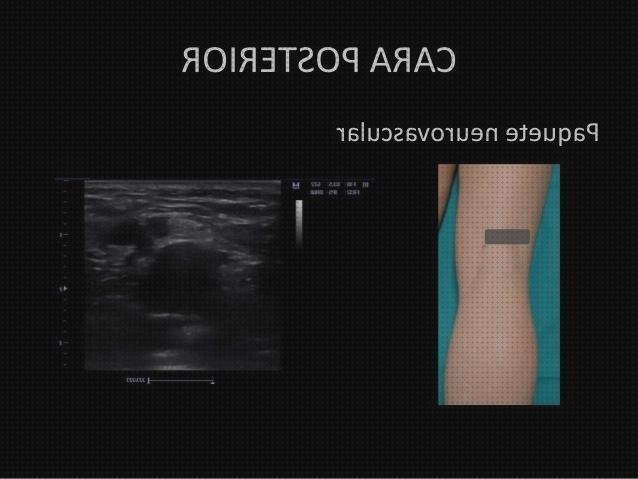 Las mejores marcas de ecografía cara bebe Mas ecografía coneja ecografías ecografía de la cara posterior de la rodilla