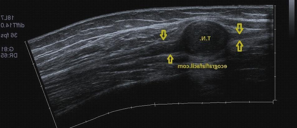 Las mejores ecografía cara bebe Mas ecografía coneja ecografías ecografía de la cara posterior de la rodilla