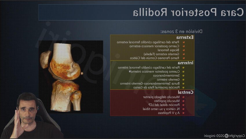Las 6 Mejores Ecografías De Las Caras Posteriores De La Rodillas
