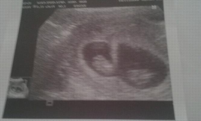 Las mejores marcas de ecografía dos meses ecografía de mellizos de 5 meses