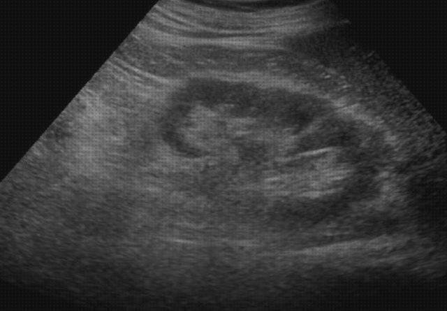 ¿Dónde poder comprar diagnostico ecografía diagnostico trocanteritis?