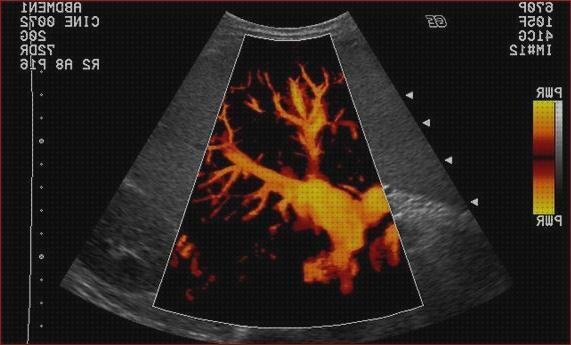 ¿Dónde poder comprar ecografias doppler ecografía doppler de flujo sanguíneo?