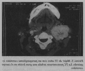 ¿Dónde poder comprar ecografía doppler paraganglioma?