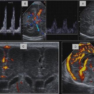 Opiniones de las 7 mejores Ecografías Doppler Transfontanelar Seram