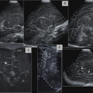¿Dónde poder comprar seram doppler ecografía doppler transfontanelar seram?