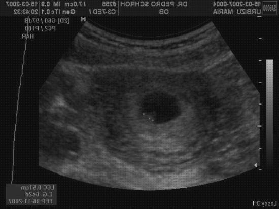 ¿Dónde poder comprar Mas ecografía segundo trimestre embarazo Mas ecografía cabeza grande Mas ecografía coneja ecografía e e 6?