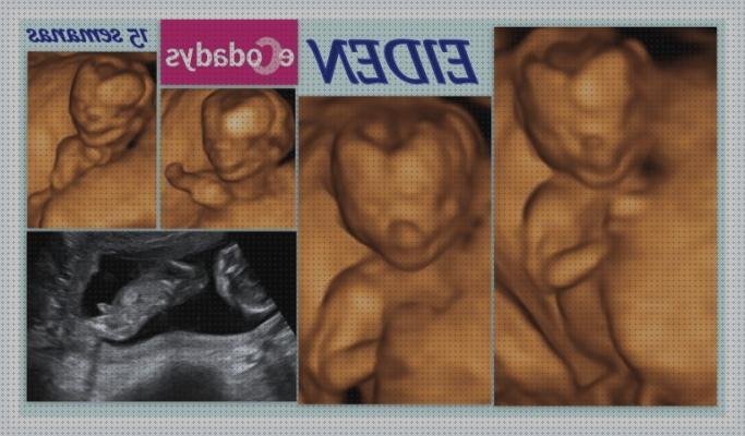 Las mejores ecografía once semanas ecografía ecodadys 29 semanas