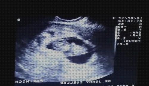 Review de ecografía embarazada de 8 semanas