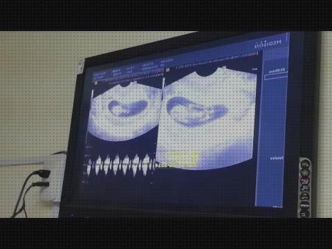 Las mejores ecografía 3 semanas embarazo ecografía once semanas ecografía embarazo 10 semanas
