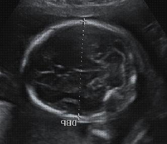 Análisis de las 13 mejores Ecografías En Cabezas De Bebés