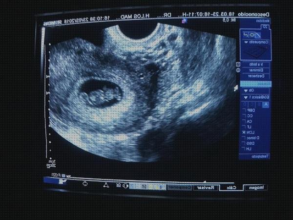 ¿Dónde poder comprar ecografía once semanas ecografía en color 8 semanas de embarazo?