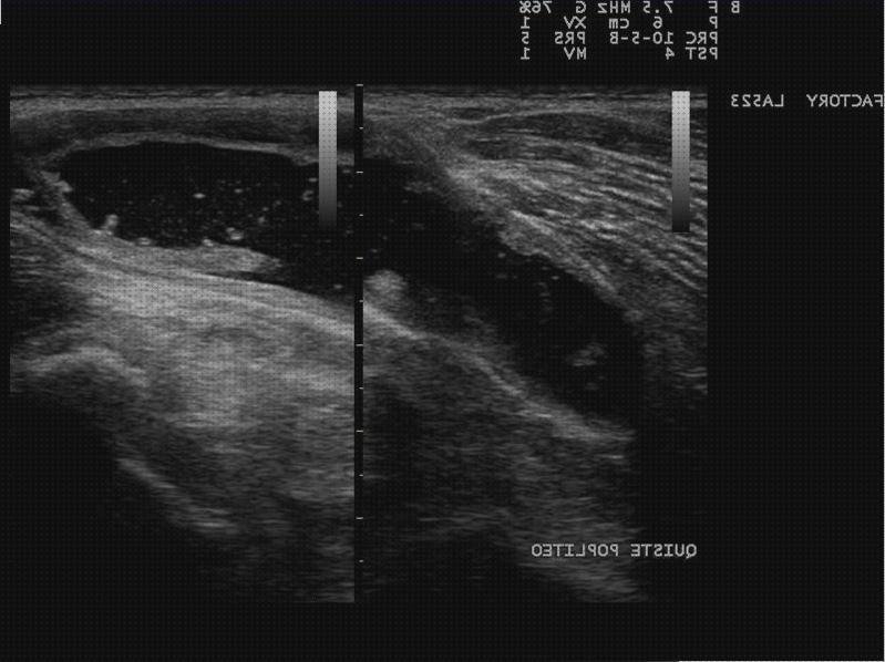 Las mejores marcas de ecografía especial embarazo Mas ecografía coneja ecografías ecografía especial de rodilla
