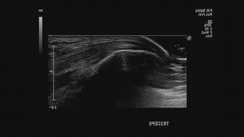 Las mejores ecografía especial embarazo Mas ecografía coneja ecografías ecografía especial de rodilla