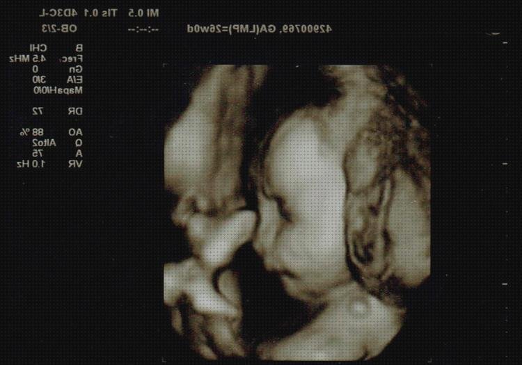 ¿Dónde poder comprar ecografía anatomía fetal ecografía fetal 3d?