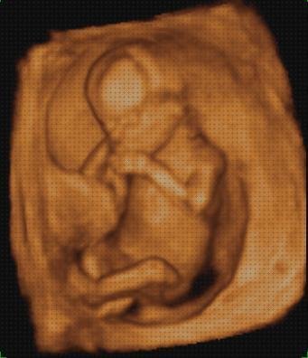 Las mejores ecografía anatomía fetal ecografía fetal 3d