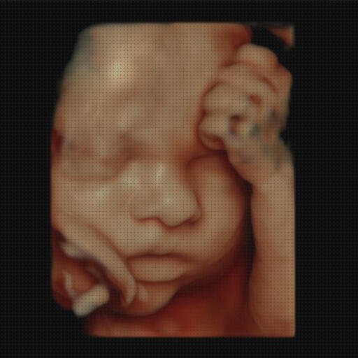 Review de ecografía fetal 3d