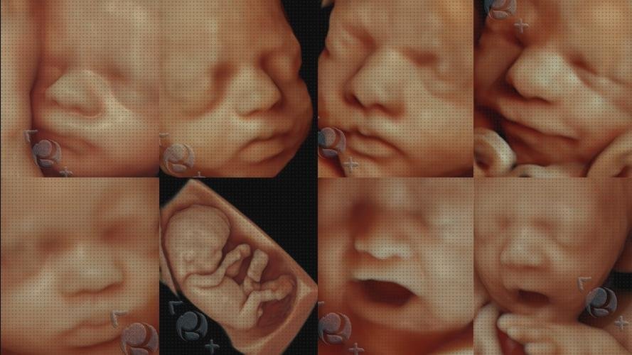 Opiniones de ecografía anatomía fetal ecografía fetal 3d