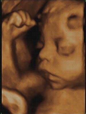 Las mejores 11 Ecografías Fetal 3d