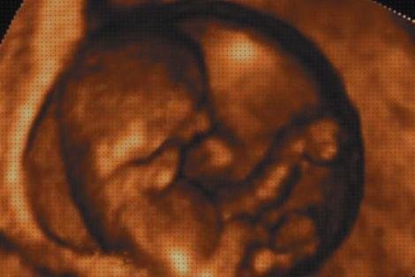 ¿Dónde poder comprar fetal ecografía fetal primero fur?