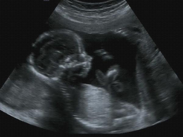 ¿Dónde poder comprar meses ecografía feto tres meses?